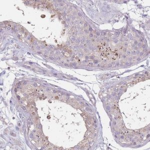 Anti-RSPH10B antibody produced in rabbit 