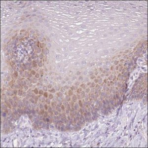 Anti-RSPO2 antibody produced in rabbit HPA053068-100UL