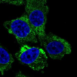Anti-RTBDN antibody produced in rabbit 