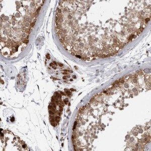 Anti-RTCA antibody produced in rabbit 