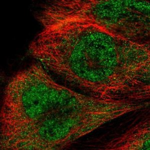 Anti-RTCB antibody produced in rabbit 