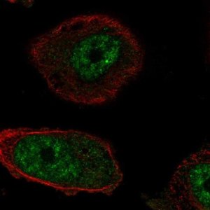 Anti-RTEL1 antibody produced in rabbit 