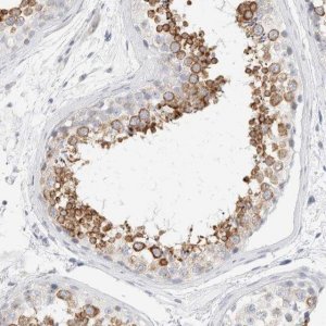 Anti-RTN4 antibody produced in rabbit 