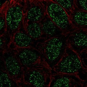 Anti-RTP4 antibody produced in rabbit 