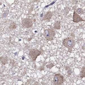 Anti-RTP5 antibody produced in rabbit 