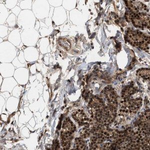 Anti-RUSC2 antibody produced in rabbit 