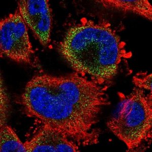 Anti-S100A3 antibody produced in rabbit 