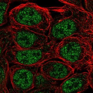 Anti-S100A5 antibody produced in rabbit 