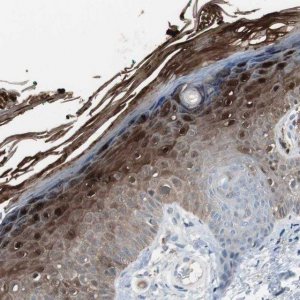 Anti-S100A7 antibody produced in rabbit 
