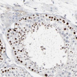 Anti-SAGE1 antibody produced in rabbit 