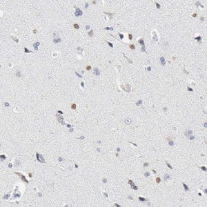Anti-SALL2 antibody produced in rabbit 