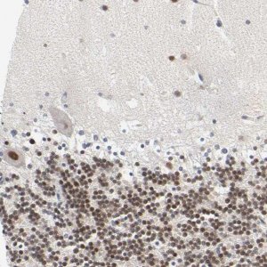 Anti-SALL2 antibody produced in rabbit 