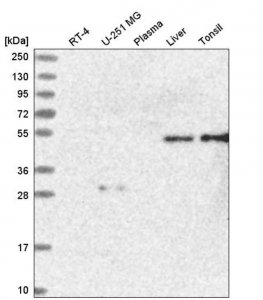 Anti-SAMD1 antibody produced in rabbit 