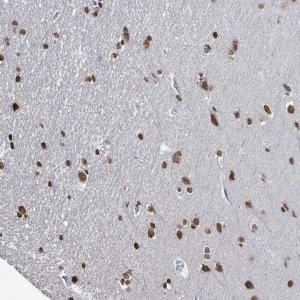 Anti-SAMD14 antibody produced in rabbit 