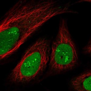 Anti-SAMD14 antibody produced in rabbit 