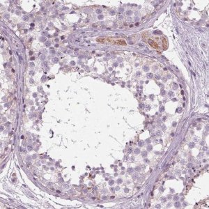 Anti-SAMD4A antibody produced in rabbit 