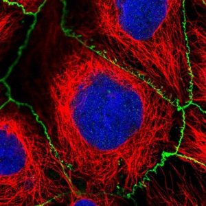 Anti-SAMD4A antibody produced in rabbit 