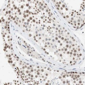 Anti-SAP18 antibody produced in rabbit 