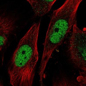 Anti-SAP30 antibody produced in rabbit 