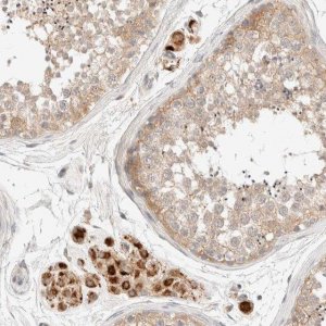 Anti-SARM1 antibody produced in rabbit 
