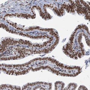 Anti-SARNP antibody produced in rabbit 