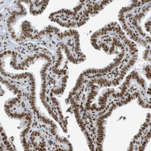 Anti-SARNP antibody produced in rabbit HPA030902-100UL