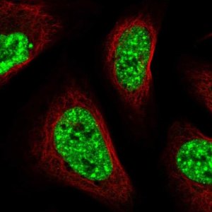 Anti-SARNP antibody produced in rabbit HPA030902-100UL
