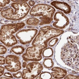 Anti-SARS2 antibody produced in rabbit 
