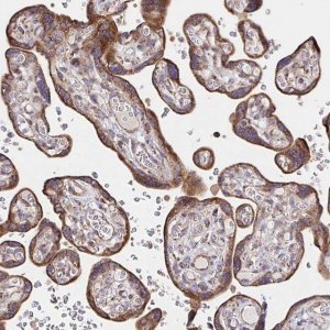 Anti-SAT1 antibody produced in rabbit 