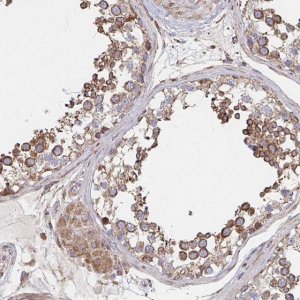 Anti-SAT1 antibody produced in rabbit 