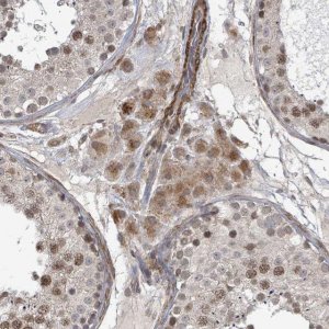Anti-SBF2 antibody produced in rabbit 
