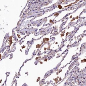 Anti-SBNO2 antibody produced in rabbit 