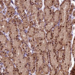 Anti-SBNO2 antibody produced in rabbit 
