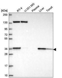Anti-SC5D antibody produced in rabbit 