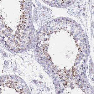 Anti-SCCPDH antibody produced in rabbit HPA050775-100UL