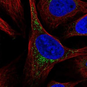 Anti-SCCPDH antibody produced in rabbit HPA050775-100UL
