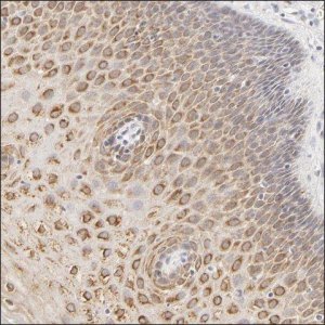 Anti-SCML2 antibody produced in rabbit HPA001662-100UL