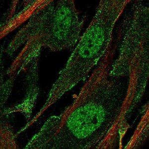 Anti-SCN1A antibody produced in rabbit 