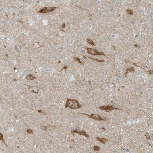 Anti-SCN3A antibody produced in rabbit 