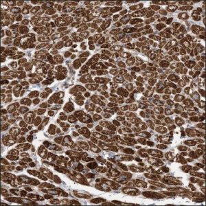 Anti-SCN3A antibody produced in rabbit HPA035397-100UL