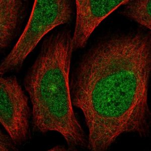 Anti-SCN4A antibody produced in rabbit 