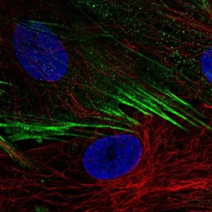 Anti-SCN9A antibody produced in rabbit 