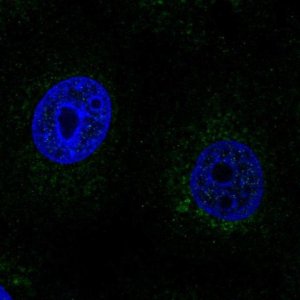 Anti-SCO2 antibody produced in rabbit 