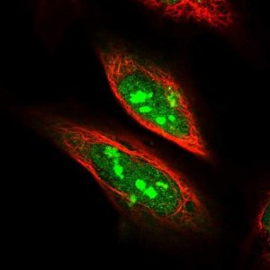 Anti-SDAD1 antibody produced in rabbit 