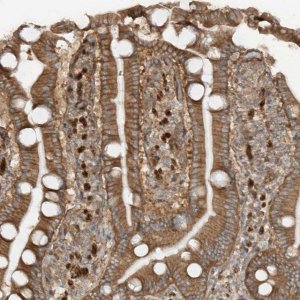 Anti-SDCCAG3 antibody produced in rabbit 