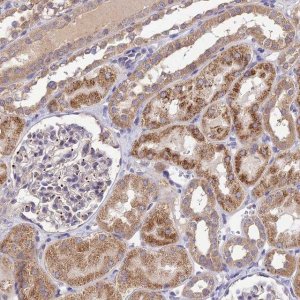 Anti-SDHD antibody produced in rabbit 
