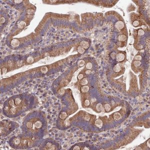 Anti-SDHD antibody produced in rabbit 