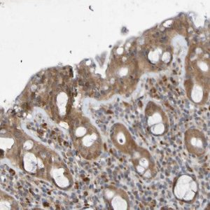 Anti-SDK1 antibody produced in rabbit 