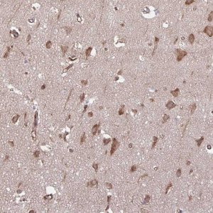 Anti-SEC62 antibody produced in rabbit 