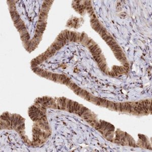 Anti-SECISBP2 antibody produced in rabbit 
